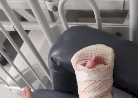 Bebê quebra perna em creche e não recebe socorro, diz mãe