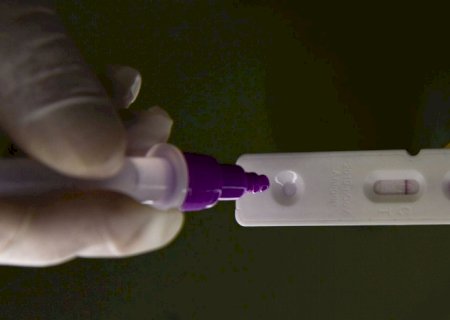 Pesquisadores identificam método capaz de prever gravidade da covid-19